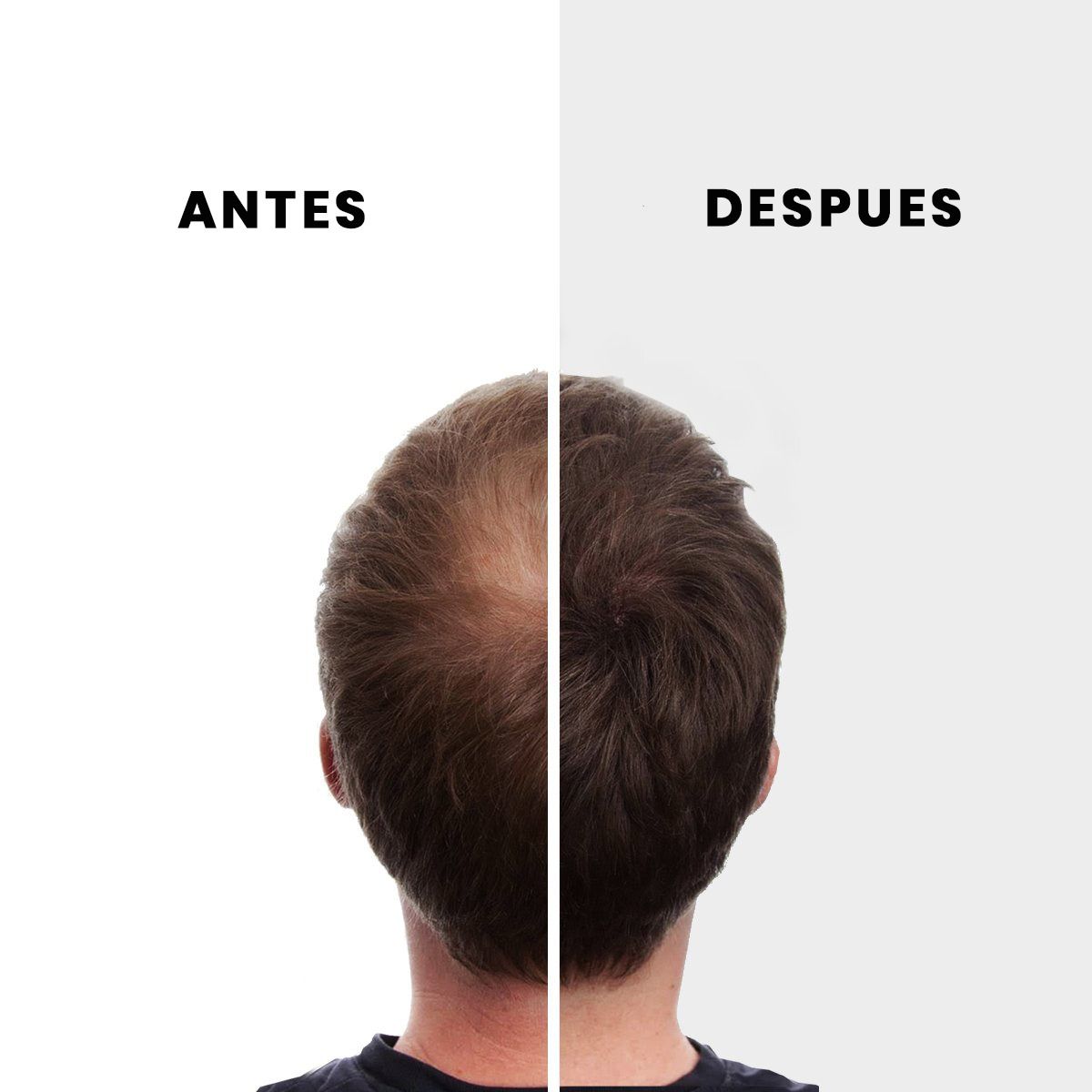 NANO HAIR - Nano Hair 50gr Castaño Medio Recarga Fibra Keratina