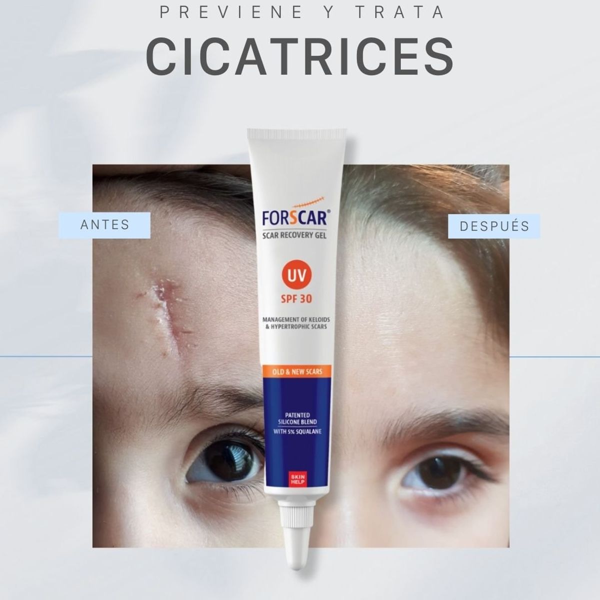 BIOLIFE IMPROVING YOU - Gel De Silicona Uv Spf 30 20 ml. Crema para mejorar cicatrices