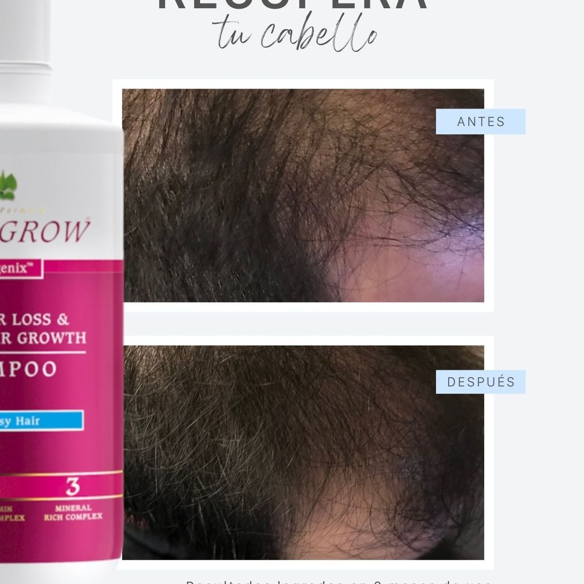 BIOLIFE IMPROVING YOU - Shampoo  Cabello Graso anticaída y rápido crecimiento del cabello
