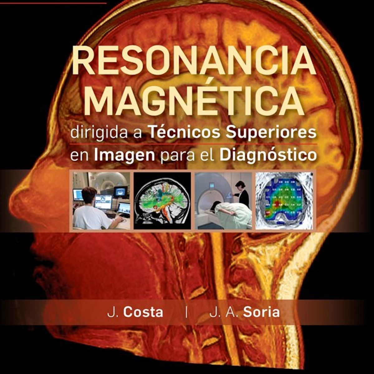 EDITORIAL MEDITERRANEO - Libro Resonancia Magnética Para Técnicos Superior