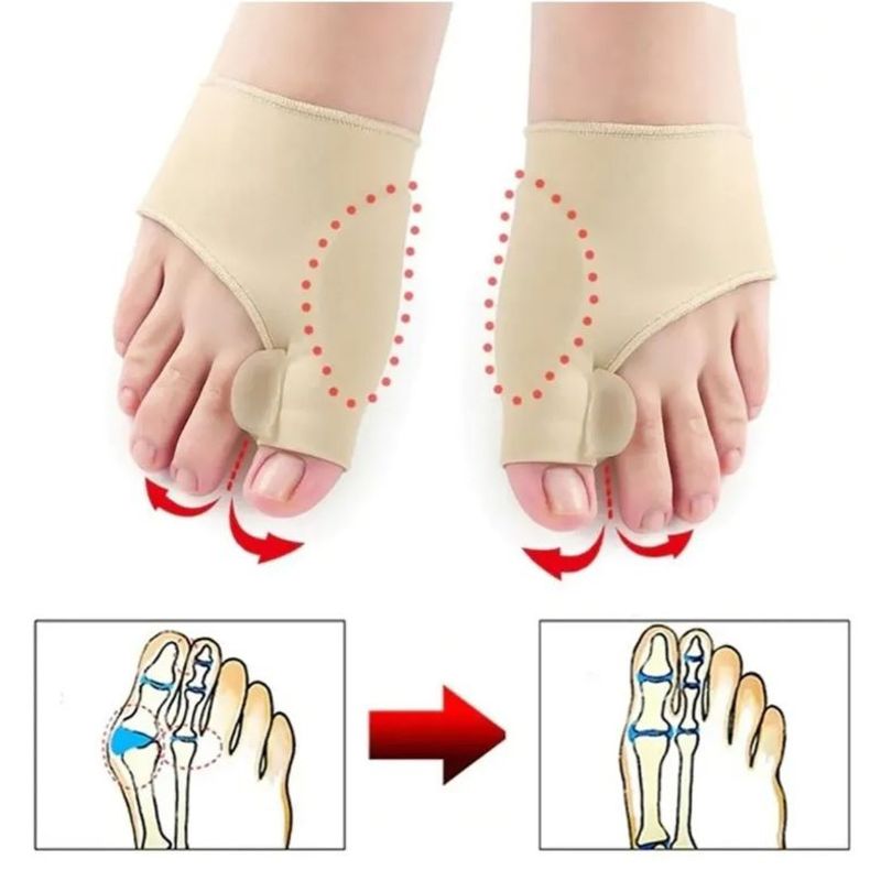 VHEX - Corrector de juanetes Hallux Valgus
