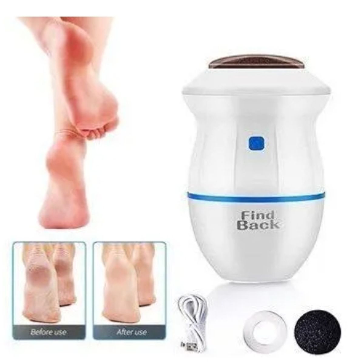 GENERICO - Removedor Quitador De Callos De Pies Pedicure Eléctrico