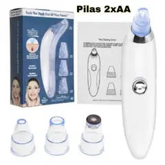 UNIVERSAL - EXTRACTOR PUNTOS NEGROS