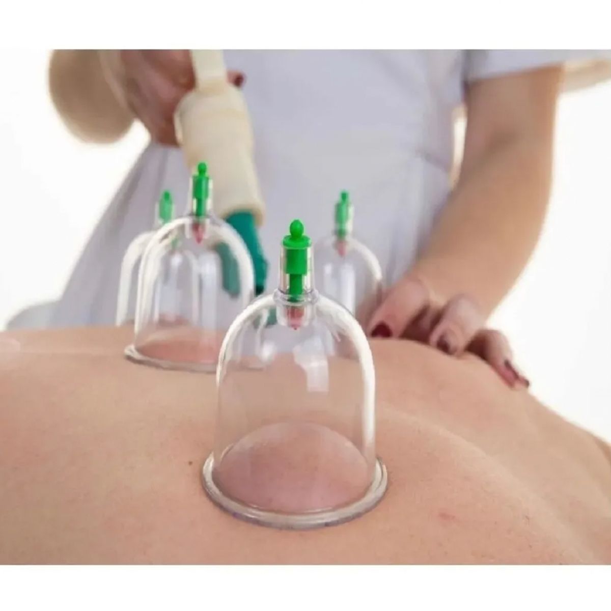 GENERICO - Ventosas China Dolores Corporal Celulitis Estética 6 Copas