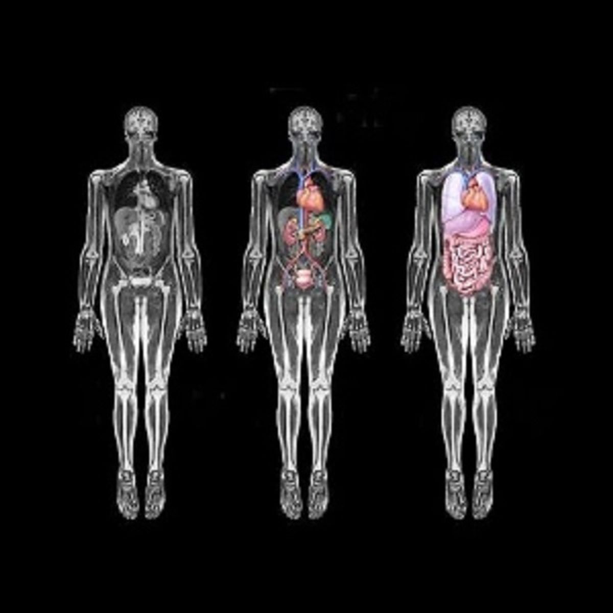 SEIGARD - Set De Imágenes De Scanner Y Resonancias Cuerpo Humano R59254 Color Variado