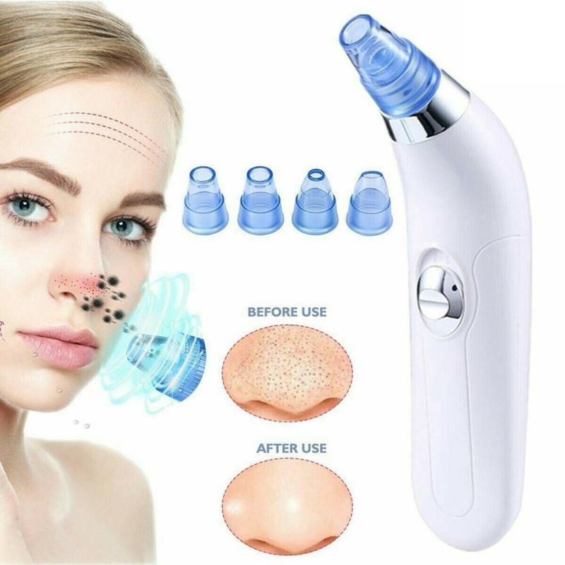 GENERICO - Extractor De Puntos Negros Limpia Poros Aspiradora Facial