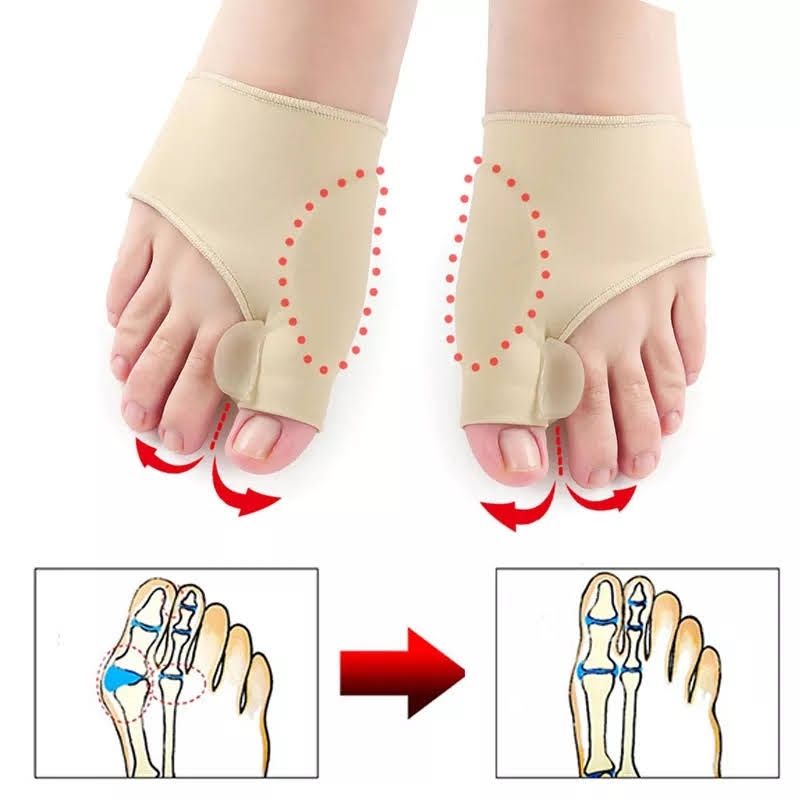 GENERICO - Corrector De Juanete Par Para Ambos Pies