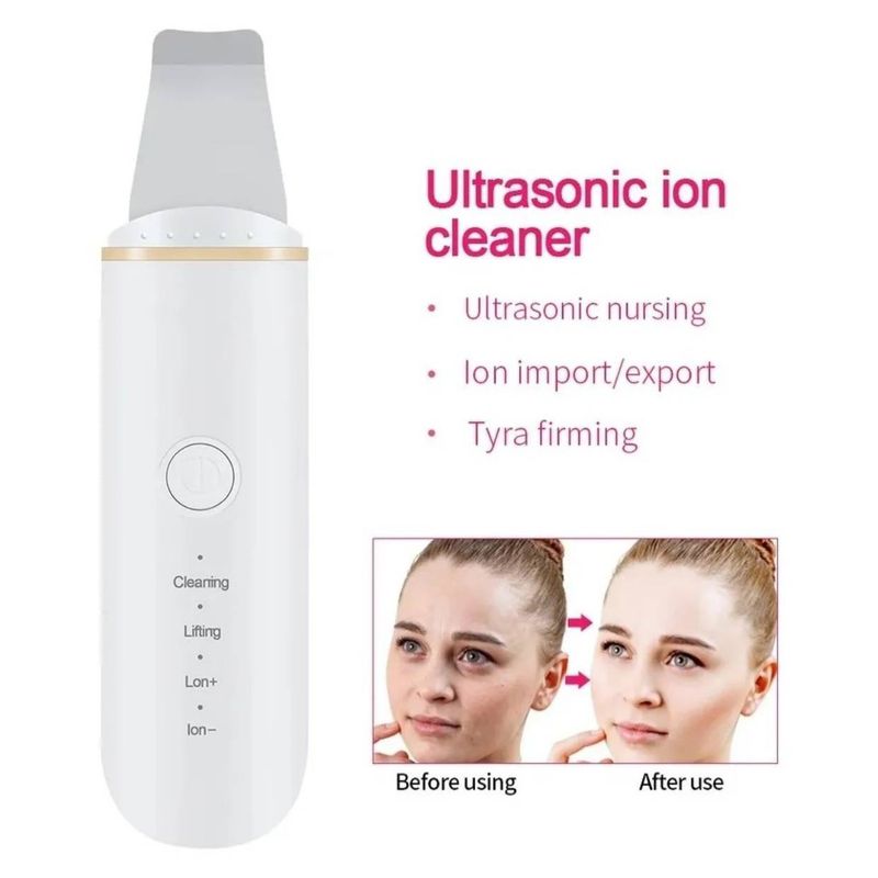 UNIVERSAL - LIMPIADOR DEPURADOR FACIAL ULTRASONICO PALETA SMART