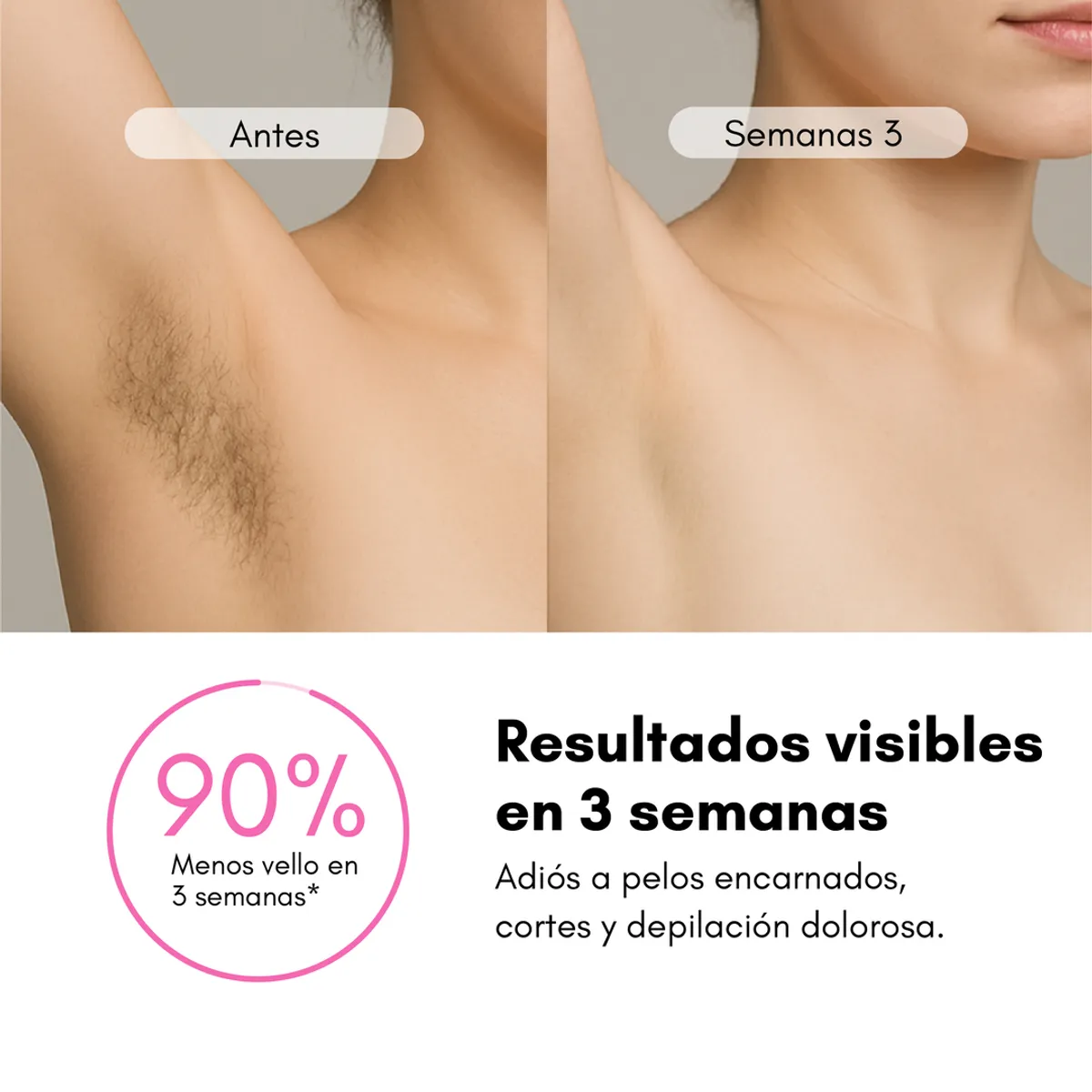 REBEL - Depiladora Láser IPL RebelSkin