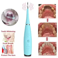 UNIVERSAL - LIMPIADOR ELÉCTRICO ESCARIFICADOR DENTAL ROSA