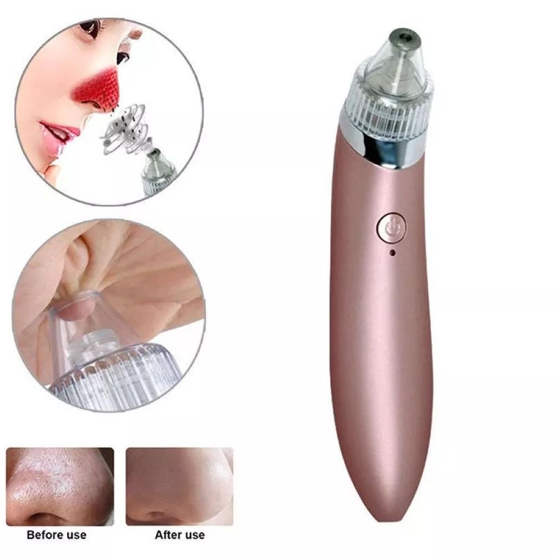 UNIVERSAL - EXTRACTOR DE PUNTOS NEGROS LIMPIEZA FACIAL COLOR ROSA GOLD