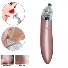 UNIVERSAL - EXTRACTOR DE PUNTOS NEGROS LIMPIEZA FACIAL COLOR ROSA GOLD