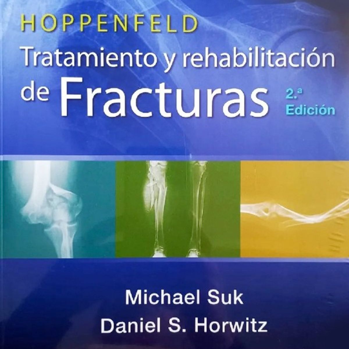 EDITORIAL MEDITERRANEO - Libro Tratamiento Y Rehabilitacion De Fracturas 5E