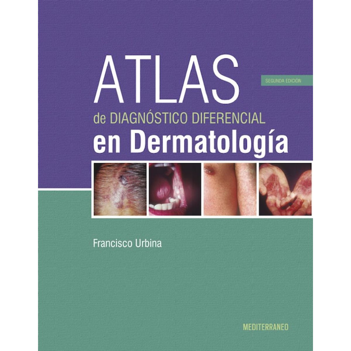 EDITORIAL MEDITERRANEO - Libro Atlas De DiagnosticoDiferencial En Dermatologia 2ed.