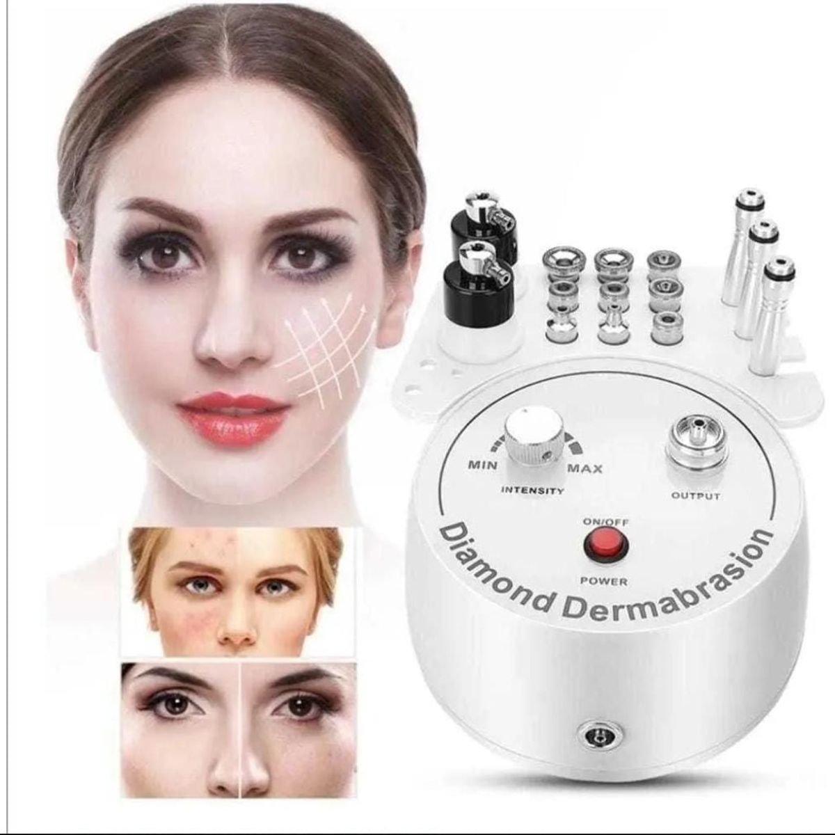 GENERICO - Microdermoabrasión Rejuvenecimiento Facial Peeling Diamond