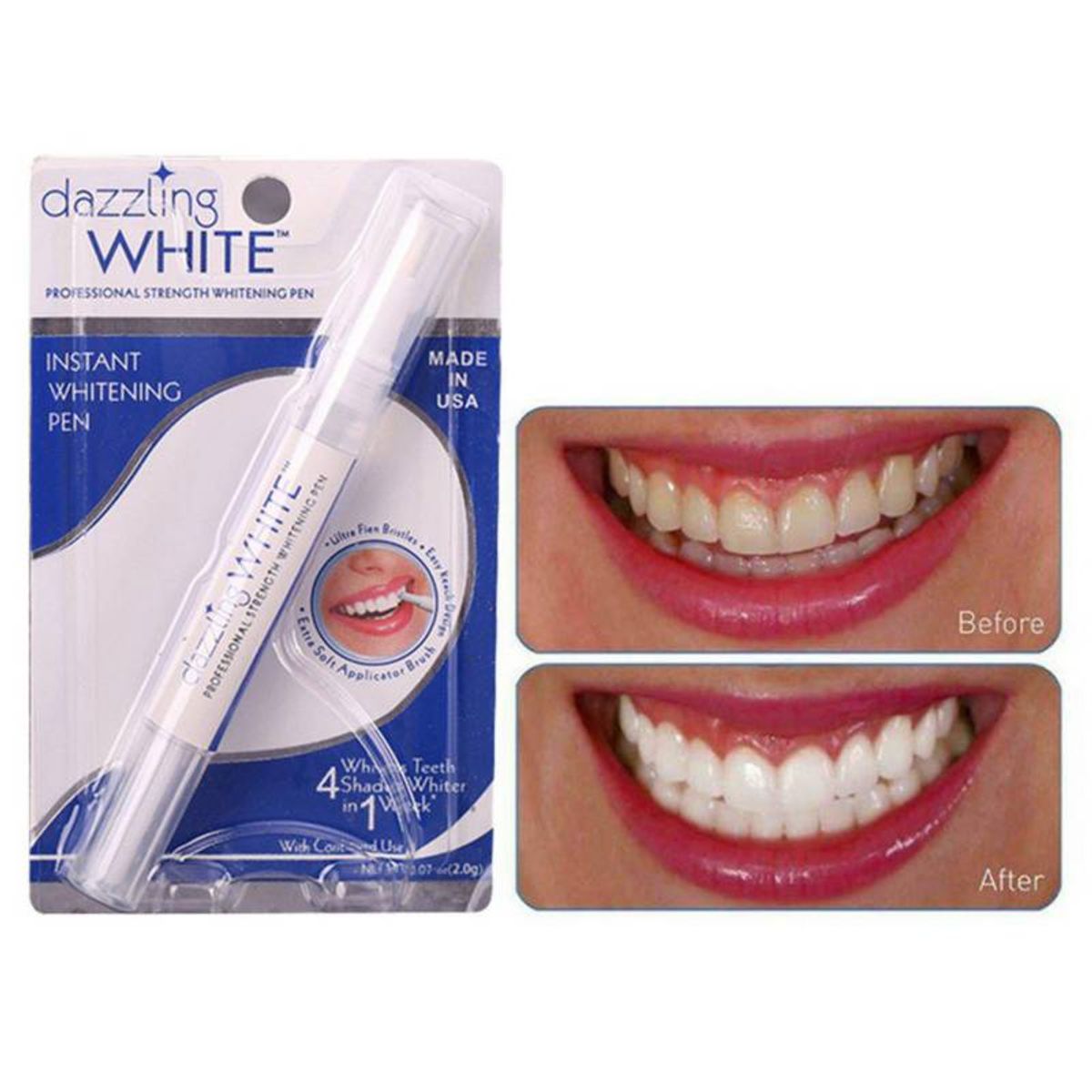 GENERICO - Lápiz Blanqueador Dental Instantáneo Dientes Peróxido Gel