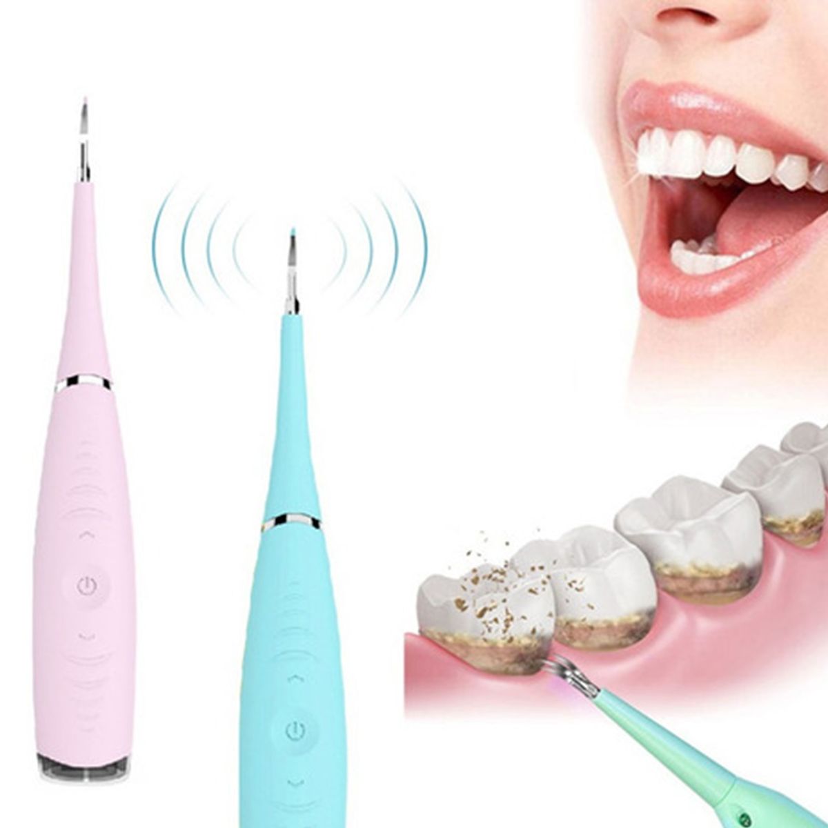 GENERICO - Removedor De Sarro Dental Limpiador De Dientes Quita sarro