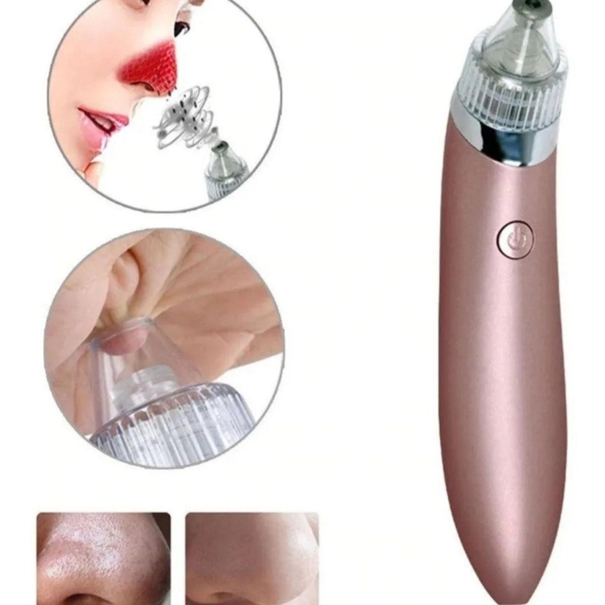 GENERICO - Removedor Extractor Puntos Negros Espinillas Recargable