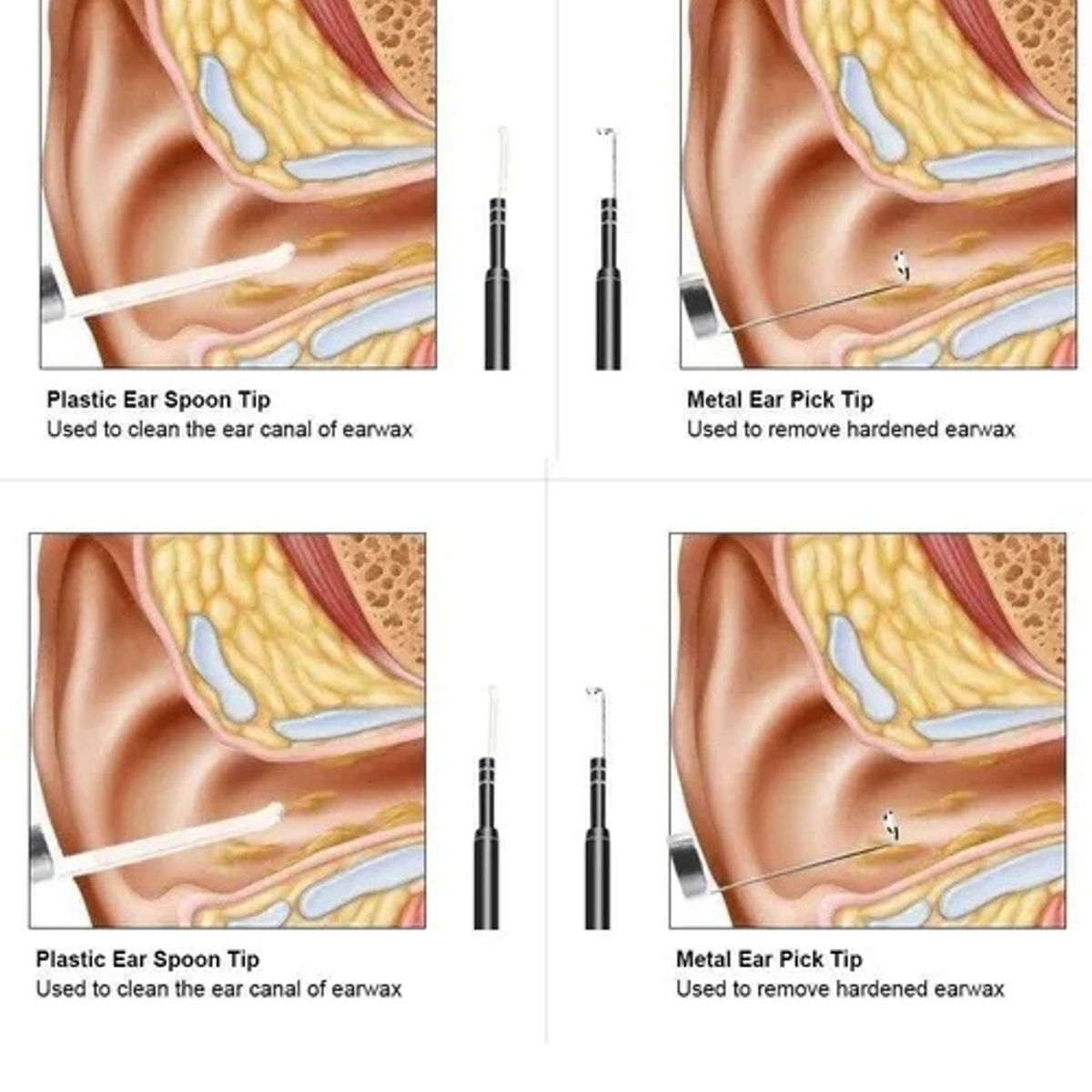 GENERICO - Limpiador De Oídos Con Cámara Usb Hd Endoscopio