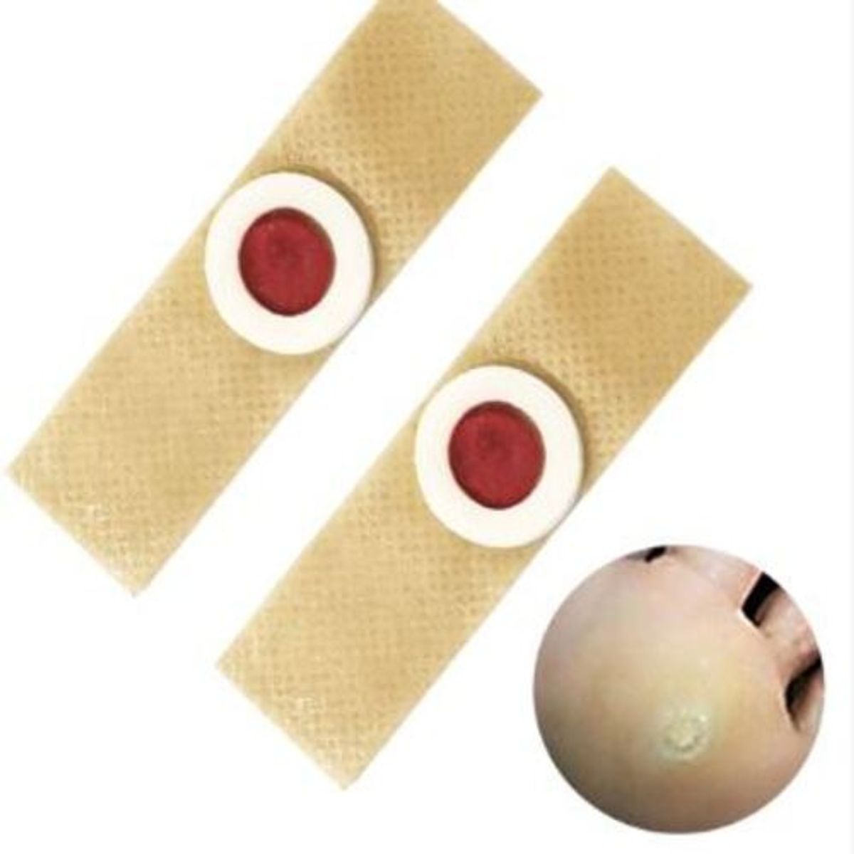 GENERICO - Parches para Eliminar Callos 6 unidades