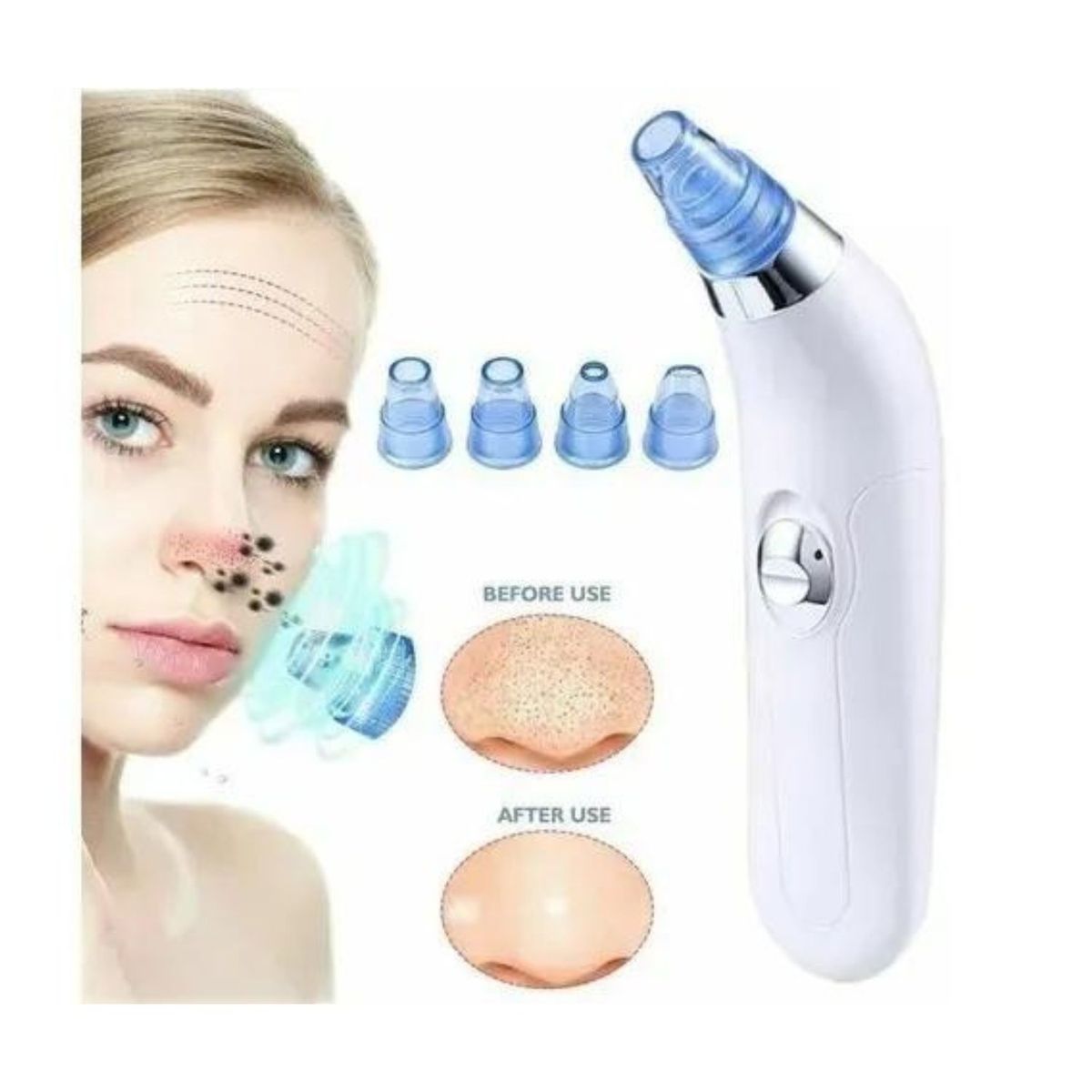 GENERICO - Extractor Removedor Puntos Negros Impurezas Espinillas