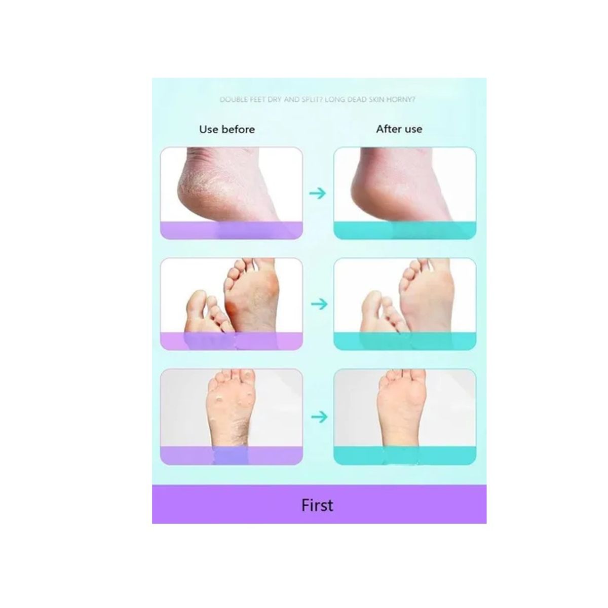 GENERICO - Set 8 Piezas Pedicure Cuidado Pies Profesional Quita Callos