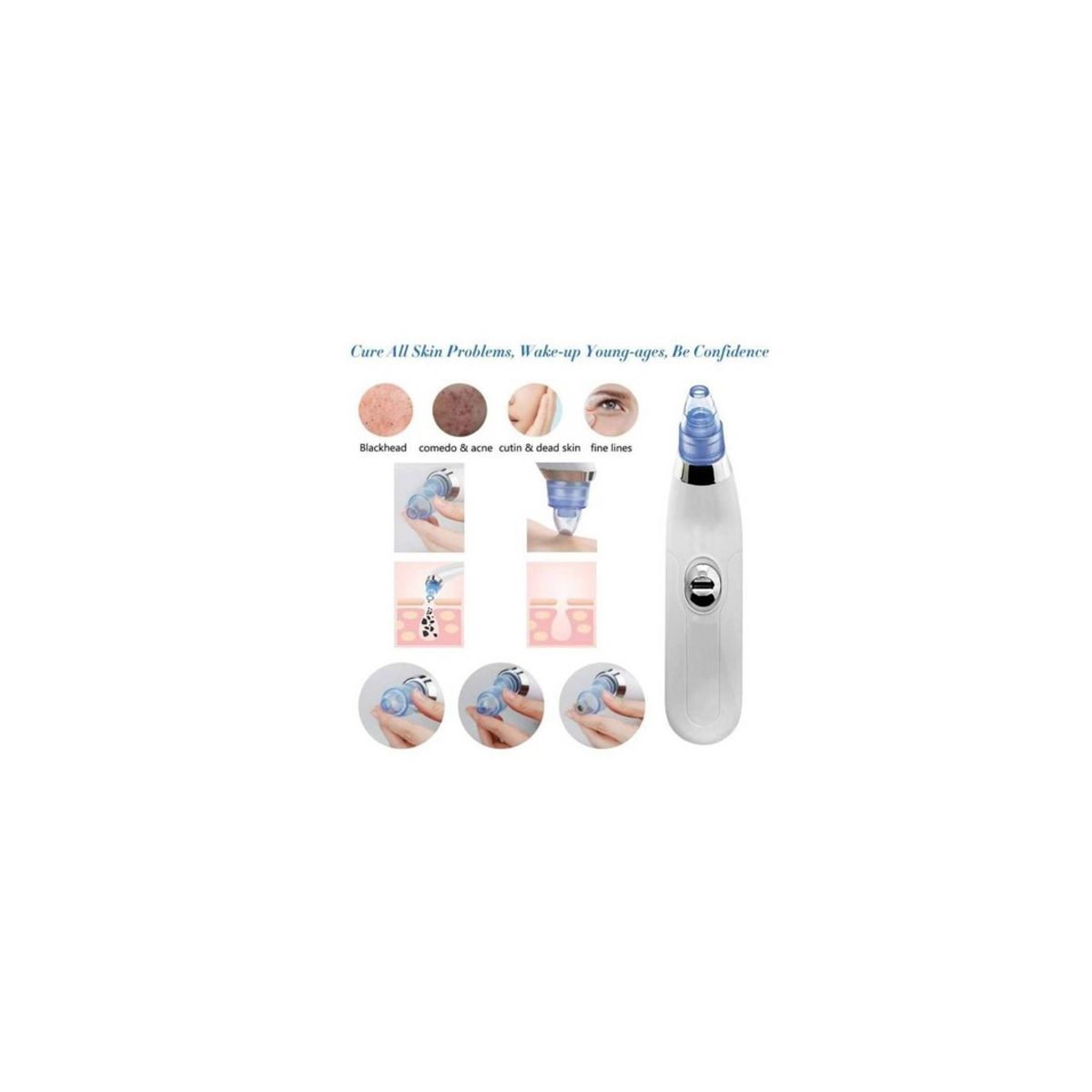 GENERICO - Extractor Puntos Negros Acne Derma Suction