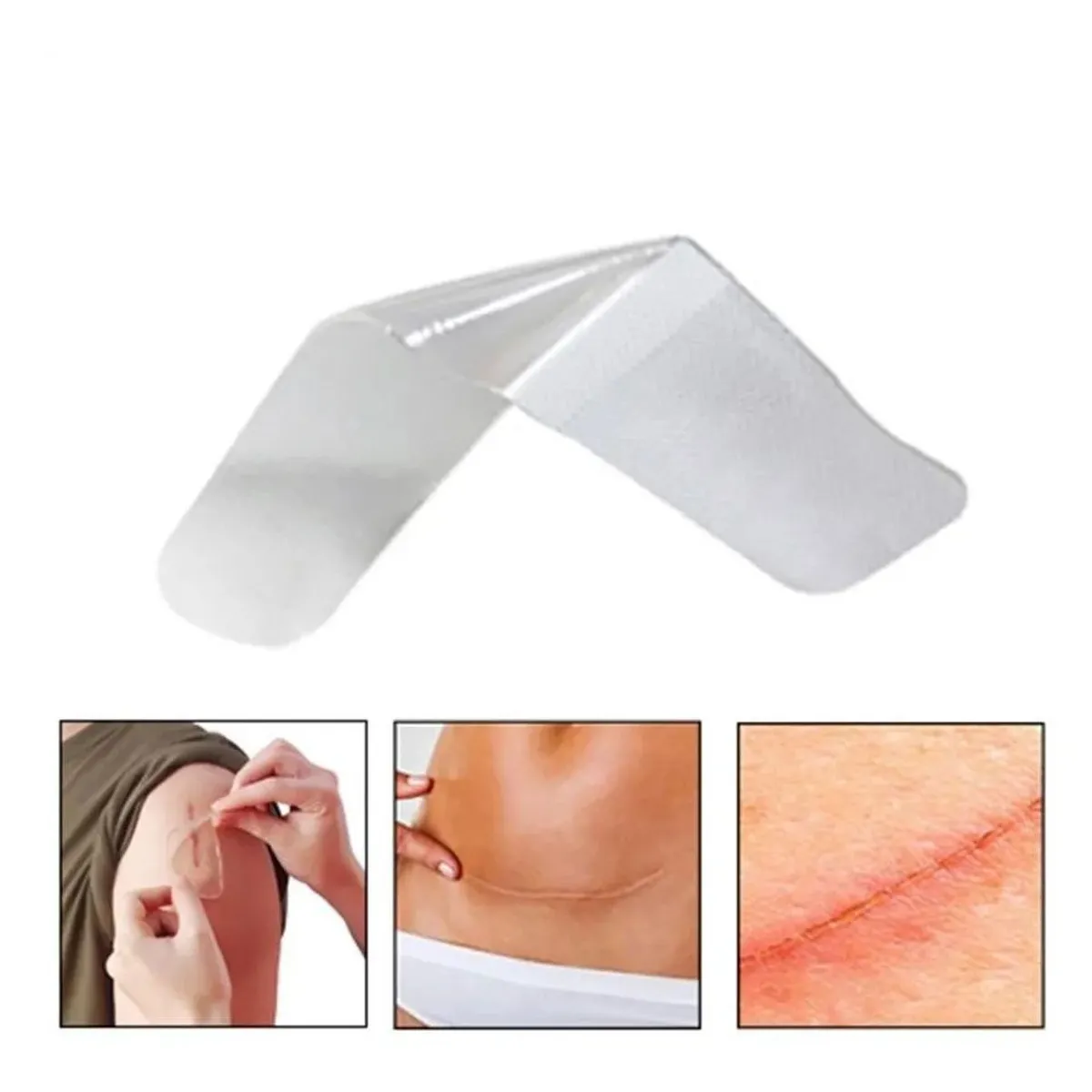 KUANGYE - Parche De Silicona Para Cicatrices Hipetróficas Y Queloides