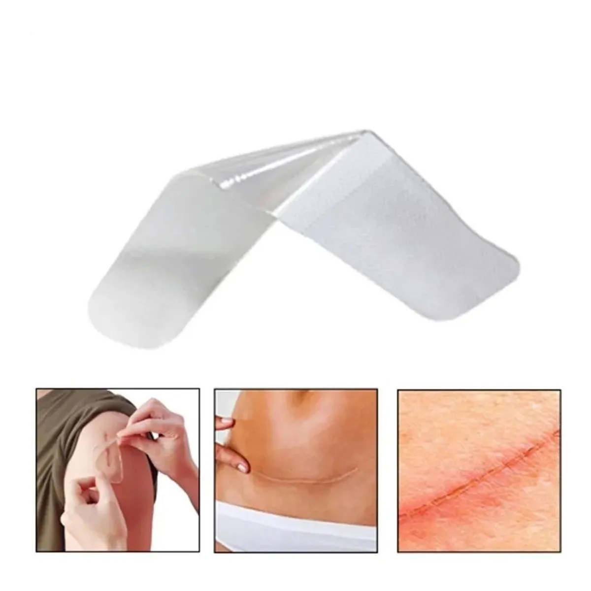 KUANGYE - Parche De Silicona Para Cicatrices Hipetróficas Y Queloides