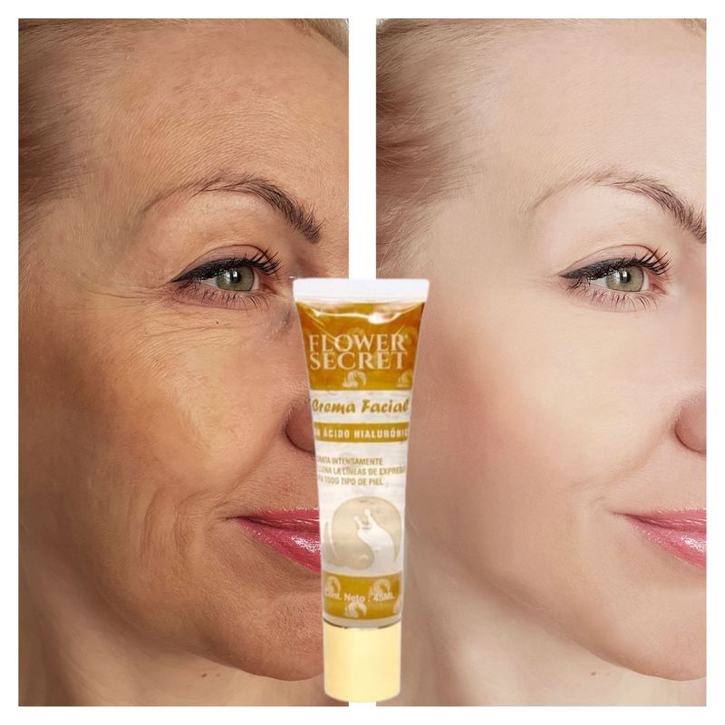 GENERICO - CREMA FACIAL DE ACIDO HIALURONICO EN GEL