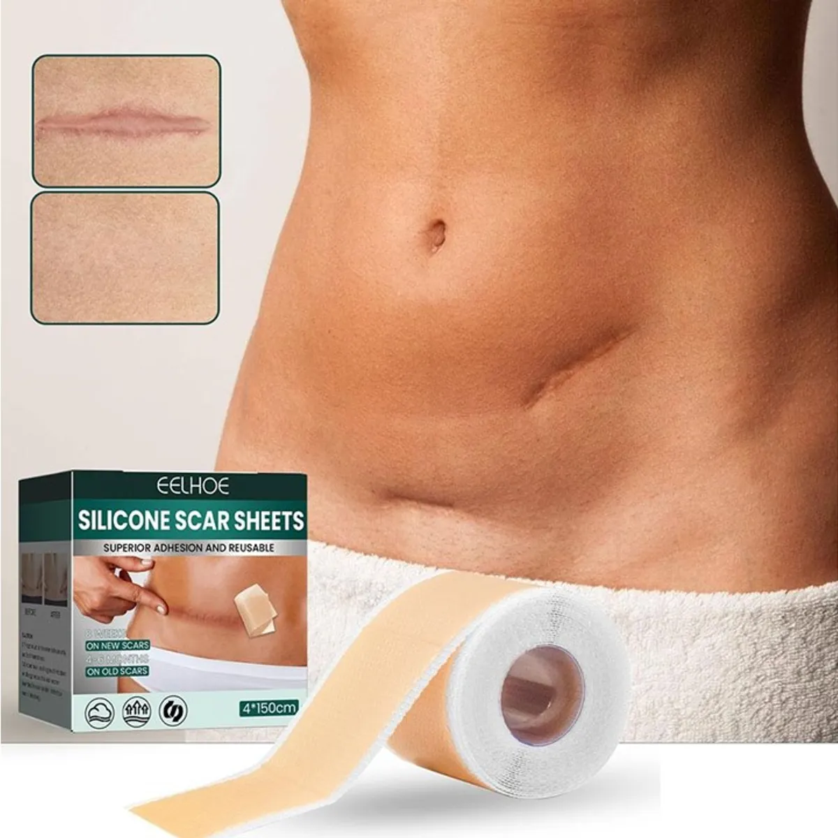 GENERICO - Parche de Silicona para Cicatrices Rollo 4cm * 1.5 metrs. Color Piel