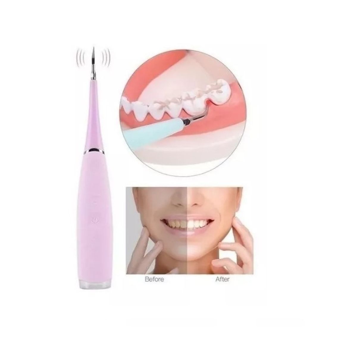 GENERICO - Limpiador De Dientes Eléctrico Removedor Sarro Recargable