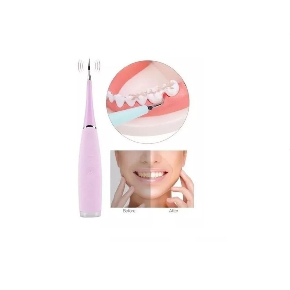 GENERICO - Limpiador De Dientes Eléctrico Removedor Sarro Recargable