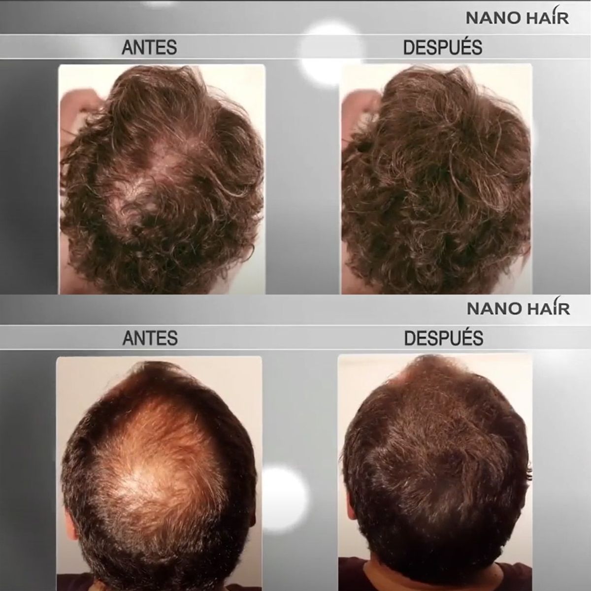 NANO HAIR - Kit Recarga microfibra Alopecia Nano Hair 100gr Negro