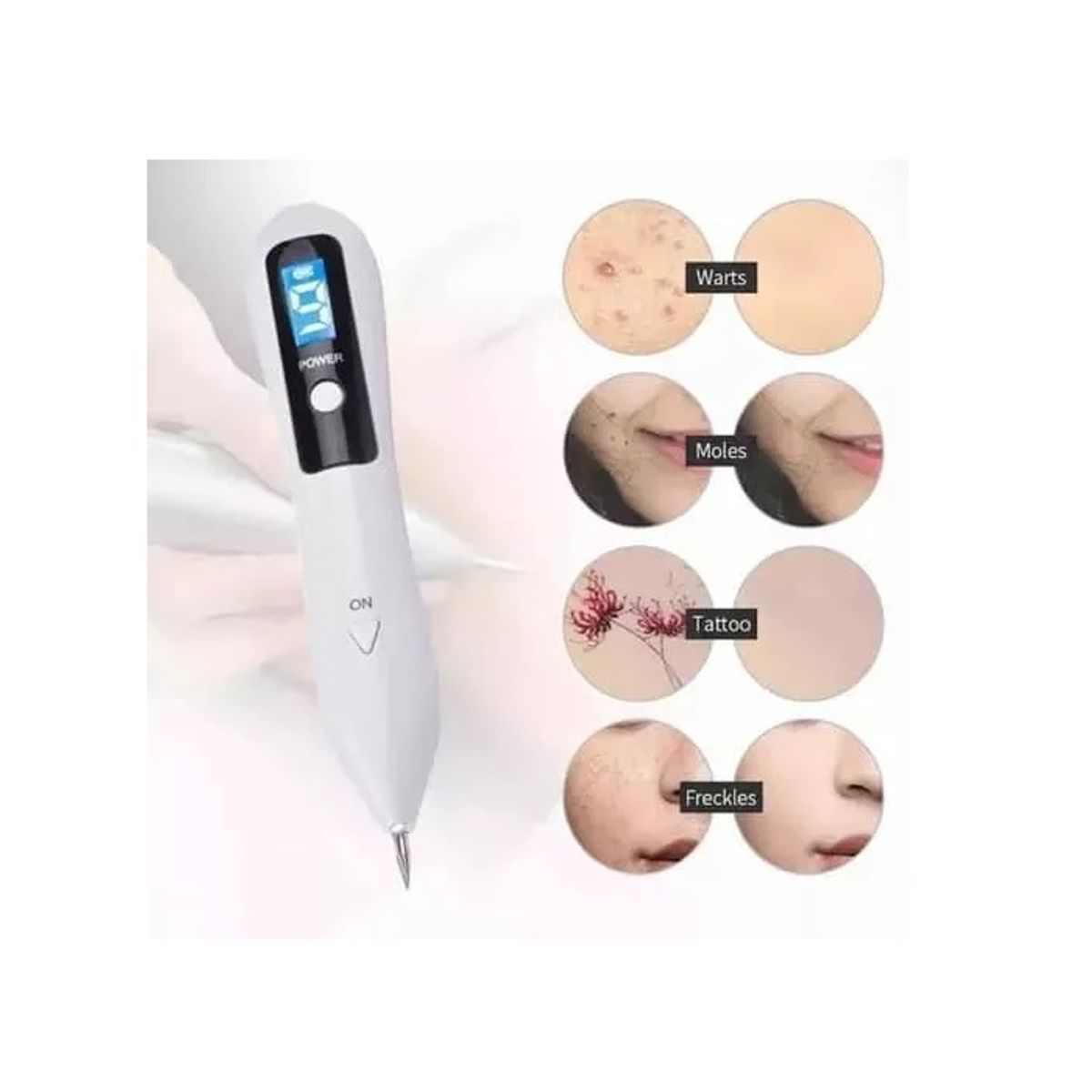 GENERICO - Lápiz Cauterizador Quita Verrugas Y Lunares