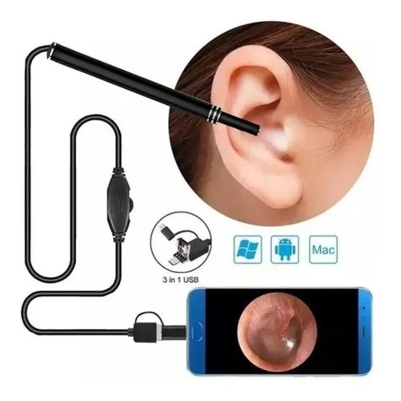 KUANGYE - Mini Cámara Endoscopio Limpieza Oidos Otoscopio Dental Y Mas