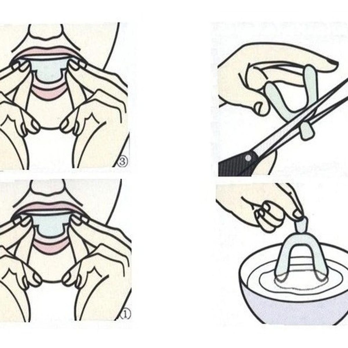 GENERICO - Pack por 2 Protector Bucal Bruxismo
