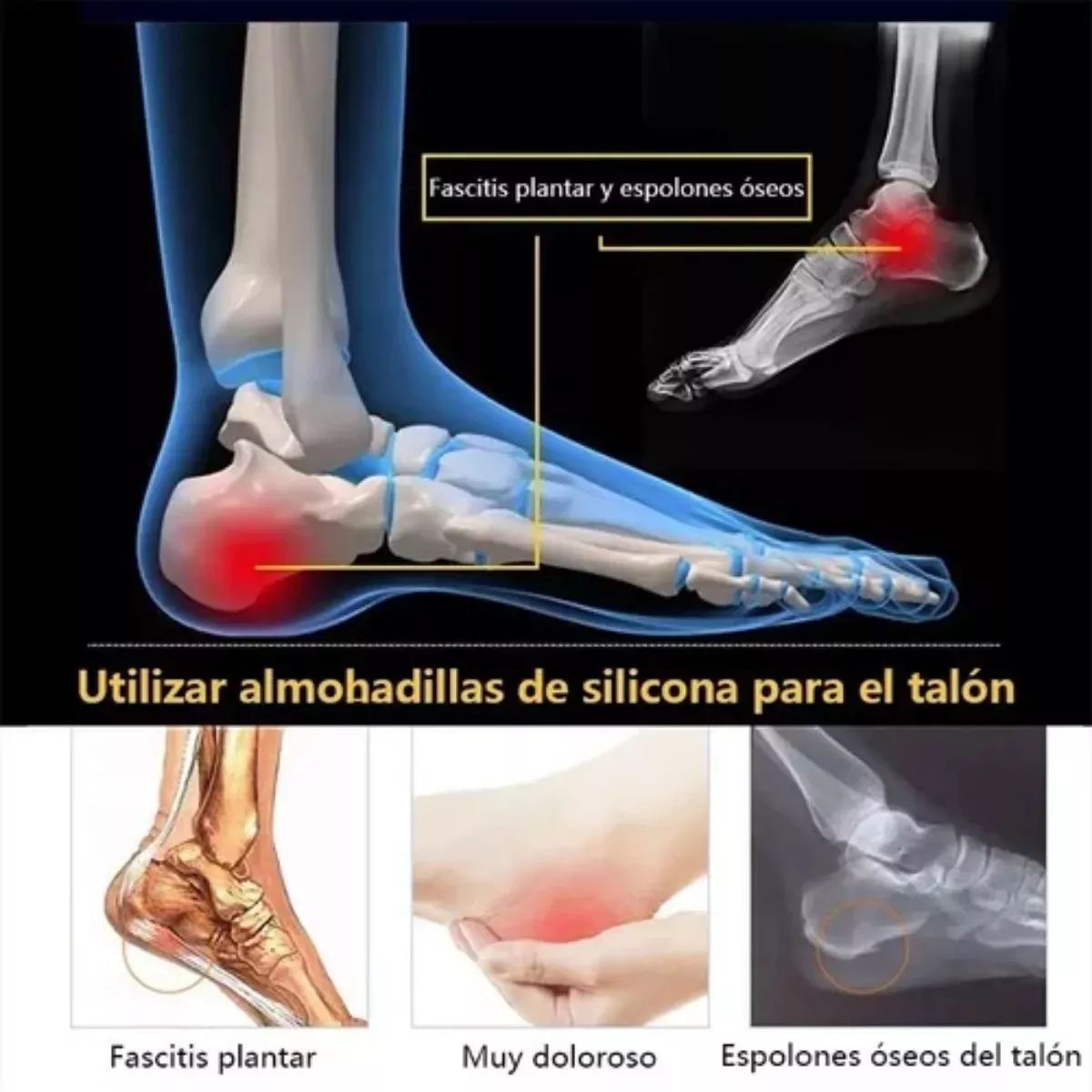 KUANGYE - Pack 6 Plantillas Silicona Taloneras Espolón