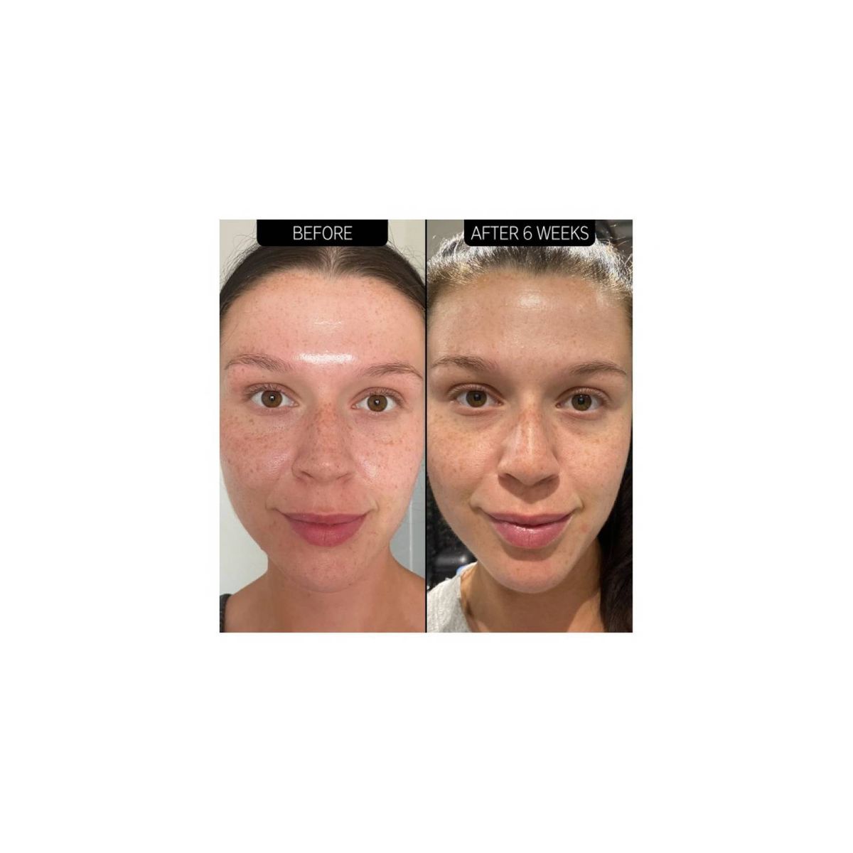 THE INKEY LIST - Suero Niacinamida al 20%  30ml -THE INKEY LIST