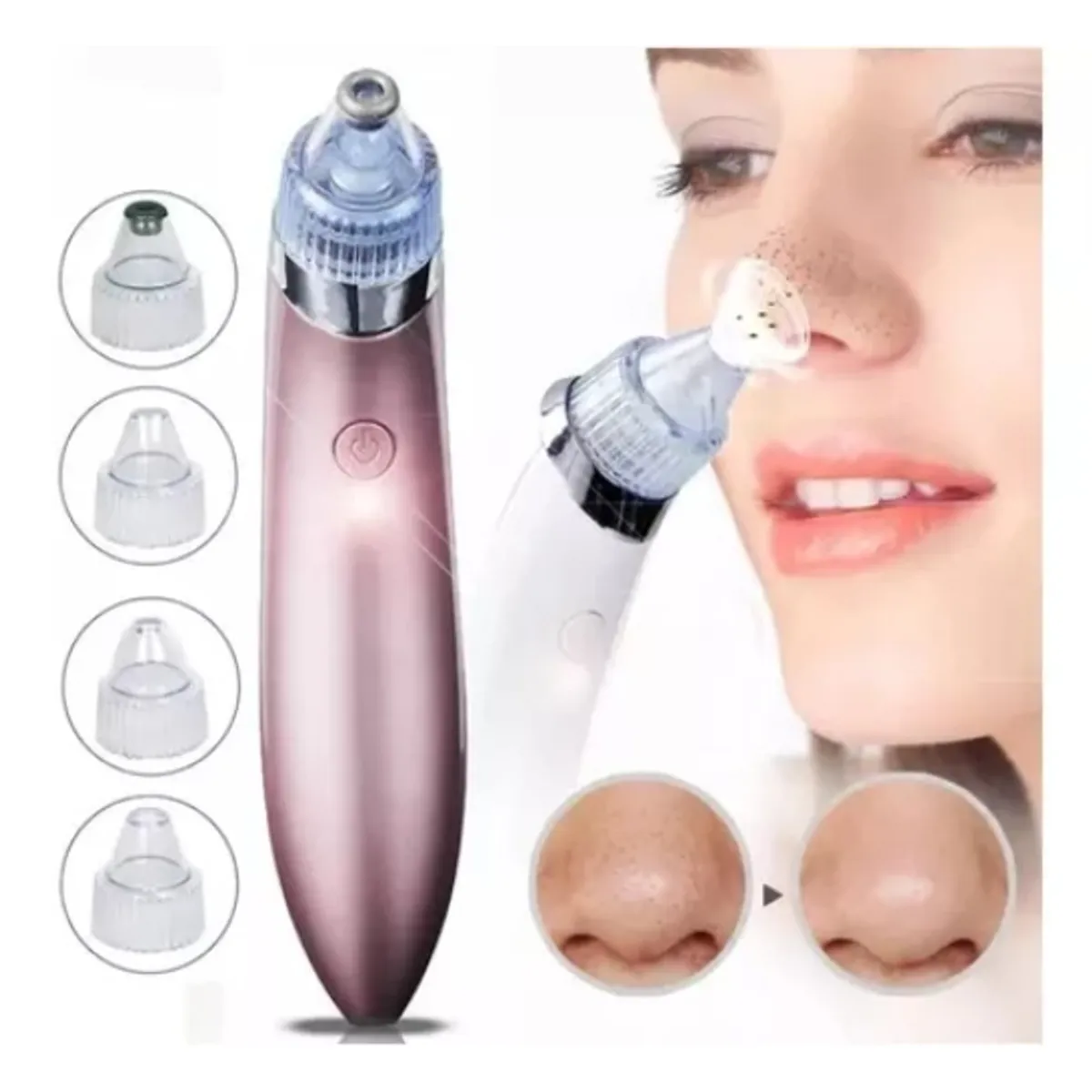 GENERICO - Removedor y Limpiador Facial Elimina Puntos Negros