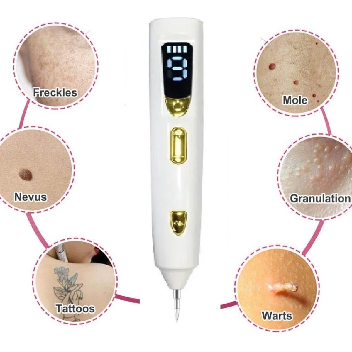 GENERICO - Plasmapen 9 Potencias Lápiz Removedor De Verrugas Lunares Recargable