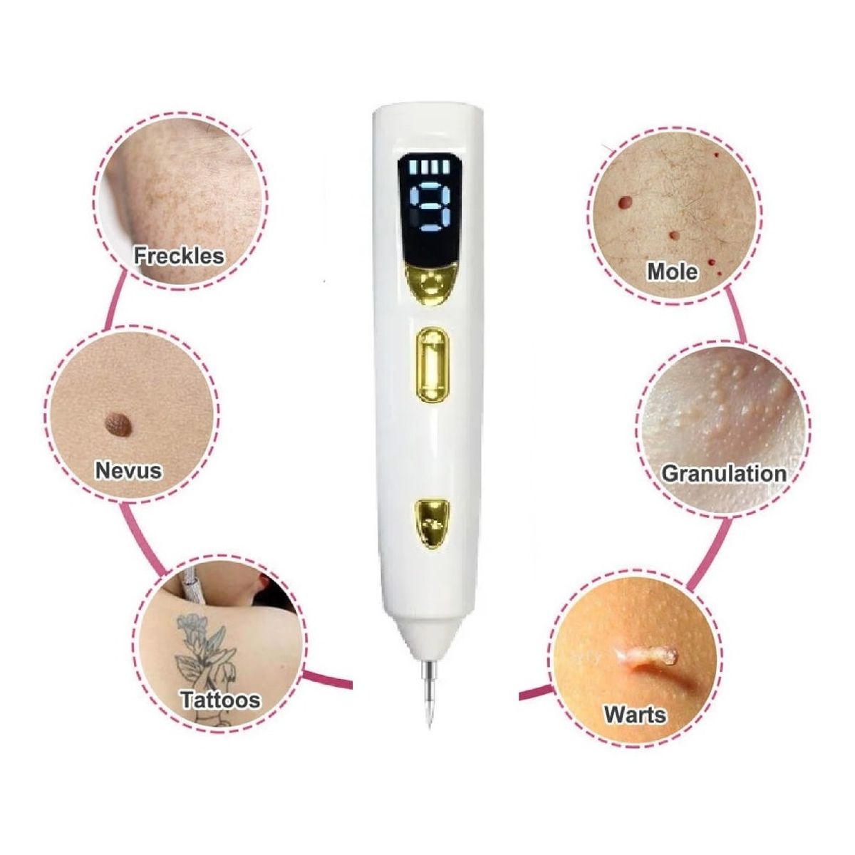 GENERICO - Plasmapen 9 Potencias Lápiz Removedor De Verrugas Lunares Recargable