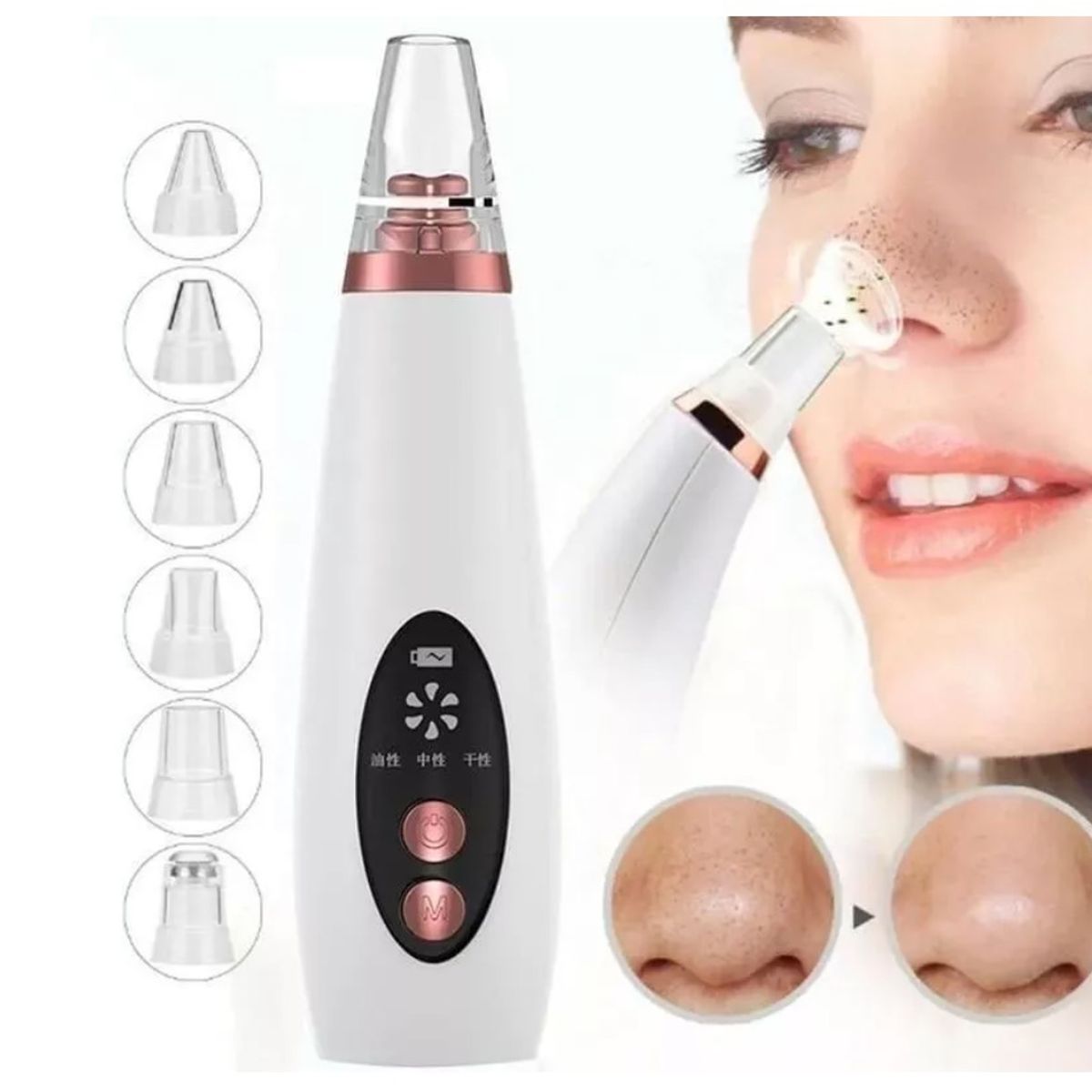 GENERICO - Aspiradora Removedor De Puntos Negros Facial Recargable