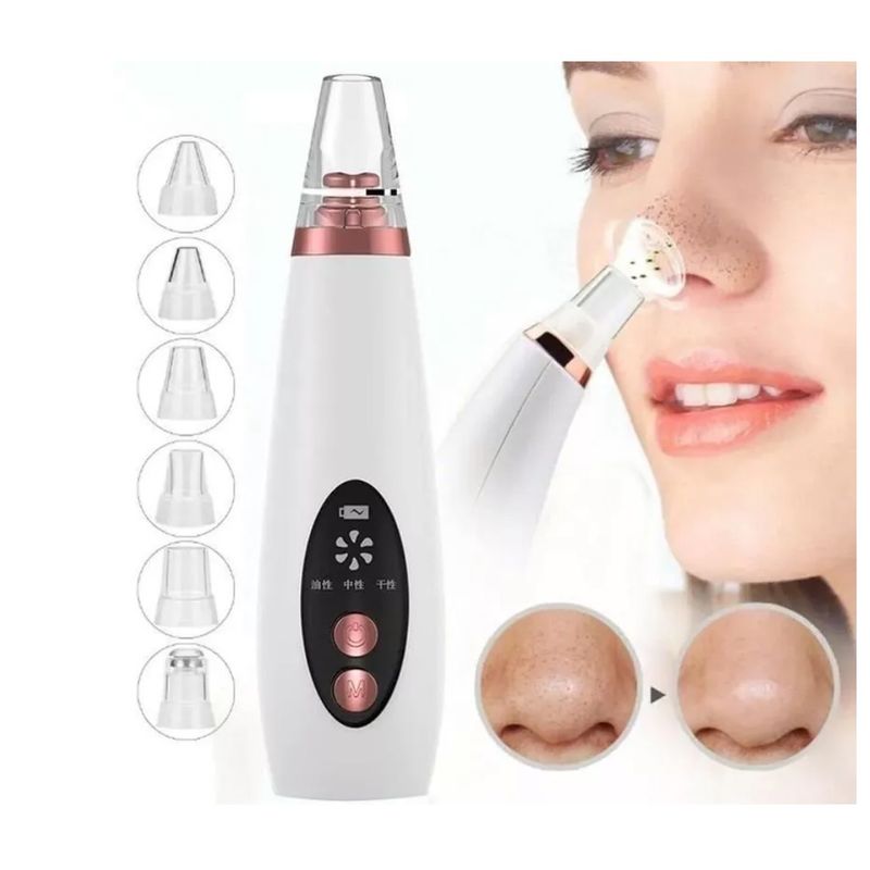 GENERICO - Aspiradora Removedor De Puntos Negros Facial Recargable