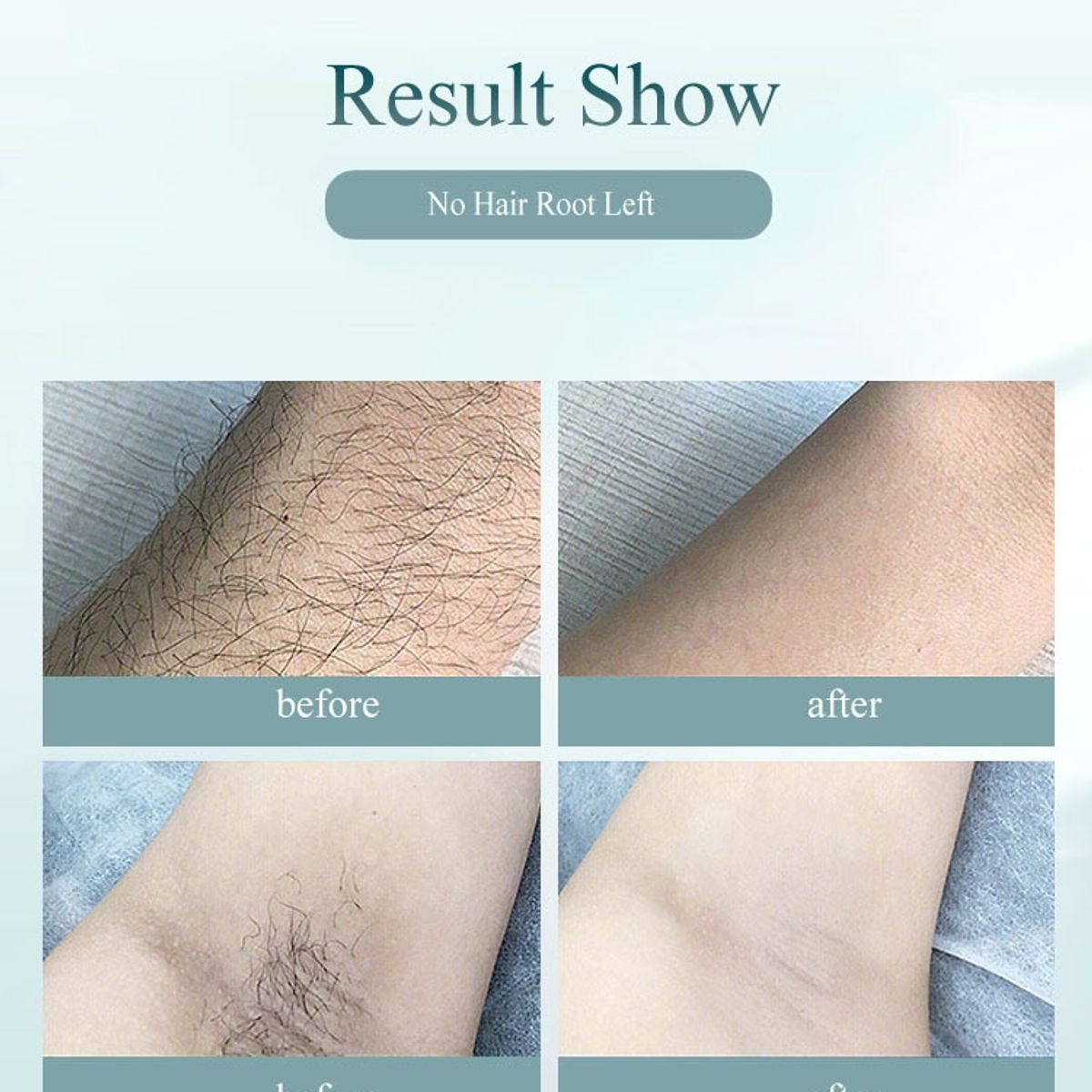 VATYERTY - Depiladora IPL 900000 láser Depiladora Profesional Permanente Verde claro