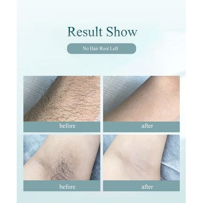 Imagen 2 del producto Depiladora IPL 900000 láser Depiladora Profesional Permanente Verde claro