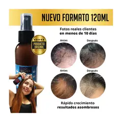 GENERICO - Spray Estimulador Del Crecimiento anti caida.-