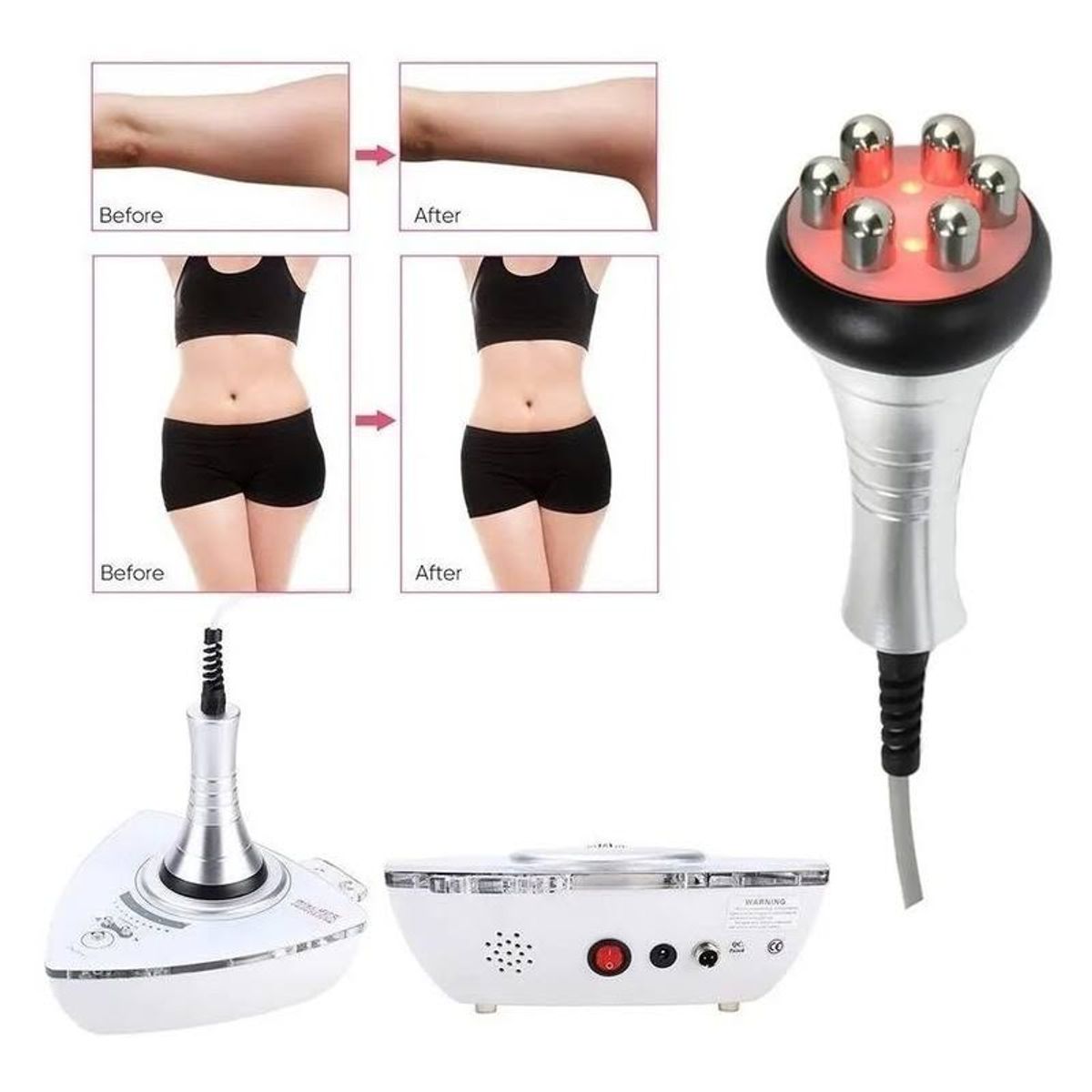 GENERICO - Maquina De Radiofrecuencia 2 En 1 Portatil Profesional