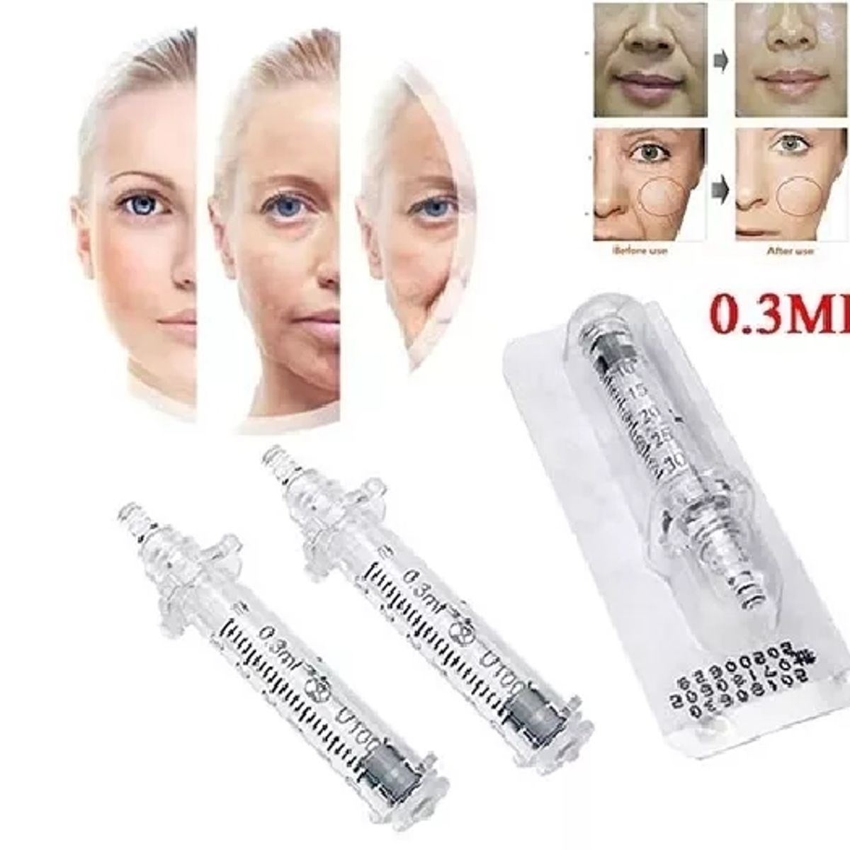 GENERICO - Jeringas Hyaluron Pen 0,3 ml ;Repuestos Pack 2 Unidades