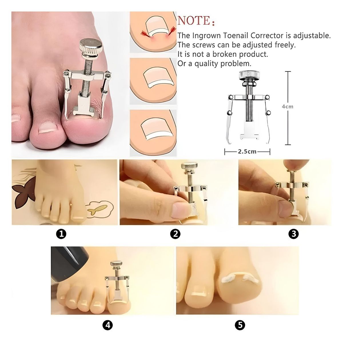 GENERICO - Set De Pedicura 9 Herramientas Para Uñas Encarnadas